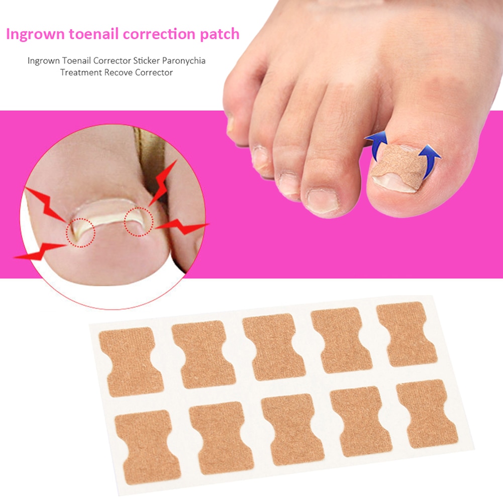 Ingrown Toenail Pedicure Patch Painless Inlay Toenail Correction Patch Painless Paronychia Fixer Recover Stickers Foot Care