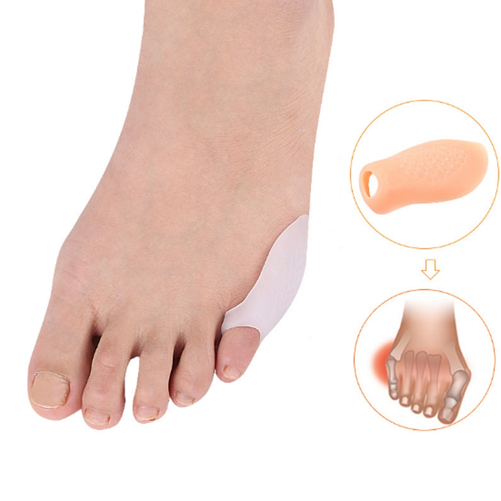 1pair=2pcs valgus braces daily night with silica gel insoles toe correction sets of points toe separator